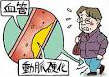 一定以上歩くとふくらはぎが重くなって歩けなくなる